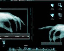 OSX-Ray